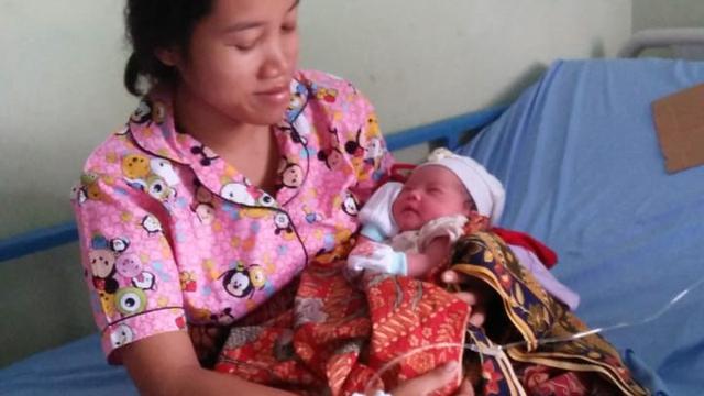 Lahir Selamat di Kendaraan Pedesaan, Bayi Ini Diberi Nama Amdes (Ist)