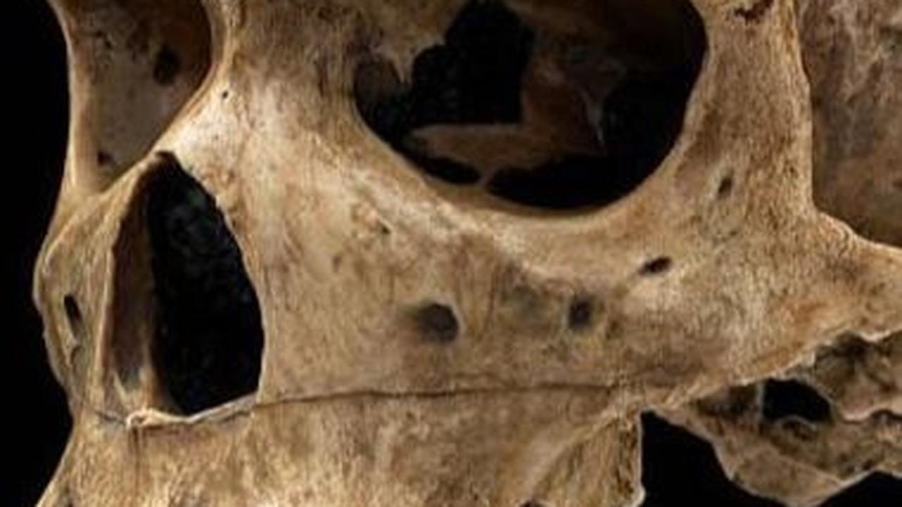 Misteri Lubang di Tengkorak Manusia Berusia 125.000 Tahun yang Mirip Luka Tembak, Arkeolog Dibikin Bingung