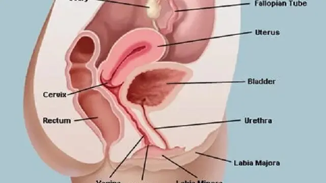 Vaginoplasty
