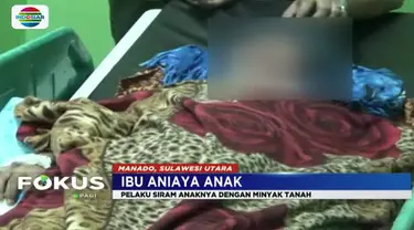 Korban mengalami luka bakar di sekujur tubuh serta wajahnya yang diduga akibat disiram minyak tanah oleh ibunya.