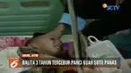 Seorang balita tercebur ke panci isi kuah soto panas saat sang ibu menyusui adik korban.