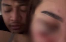 Viral Wanita Korban Penganiayaan, Wajah Lebam Bengkak dan Berdarah Ada Sosok Pria di Belakangnya