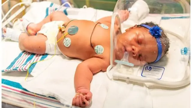 Bayi unik yang lahir pada peringatan tragedi 11 September atau 9/11. (Dokumentasi Methodist Healthcare)