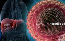 Waspadai Hepatitis: Fakta, Mitos, dan Tips Pencegahannya