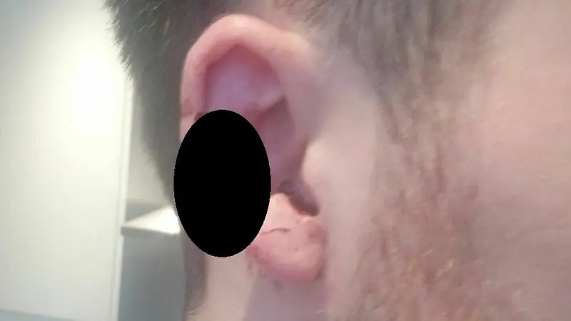 Karena menelpon terlalu berisik seorang pria berusia 24 tahun asal Inggris harus mengalami luka gigitan di bagian telinga (BRITISH TRANSPORT POLICE)