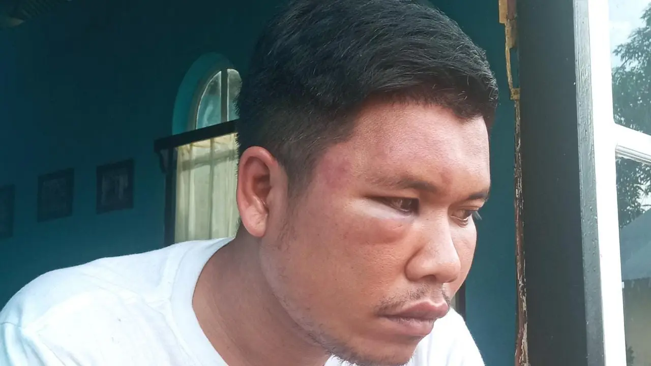 Salah satu korban Sudirman (29), Warga Desa Marisa Selatan, Kecamatan Marisa (Arfandi/Liputan6.com)