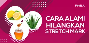 5 Cara Alami Hilangkan Stretch Mark