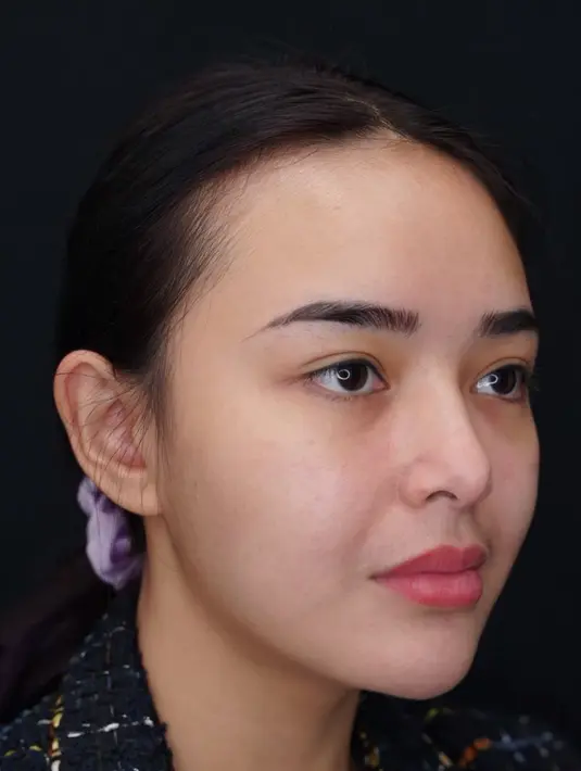 Sebaliknya, para penggemar Amanda ada yang berpendapat pipi chubby Amanda Manopo justru lebih menggambarkan ciri khasnya. (Liputan6.com/IG/@amandamanopo)