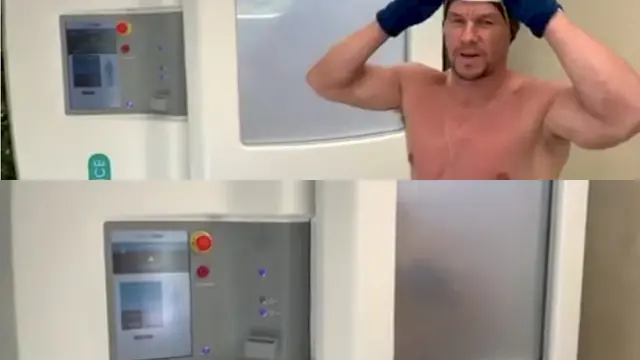 cryotherapy