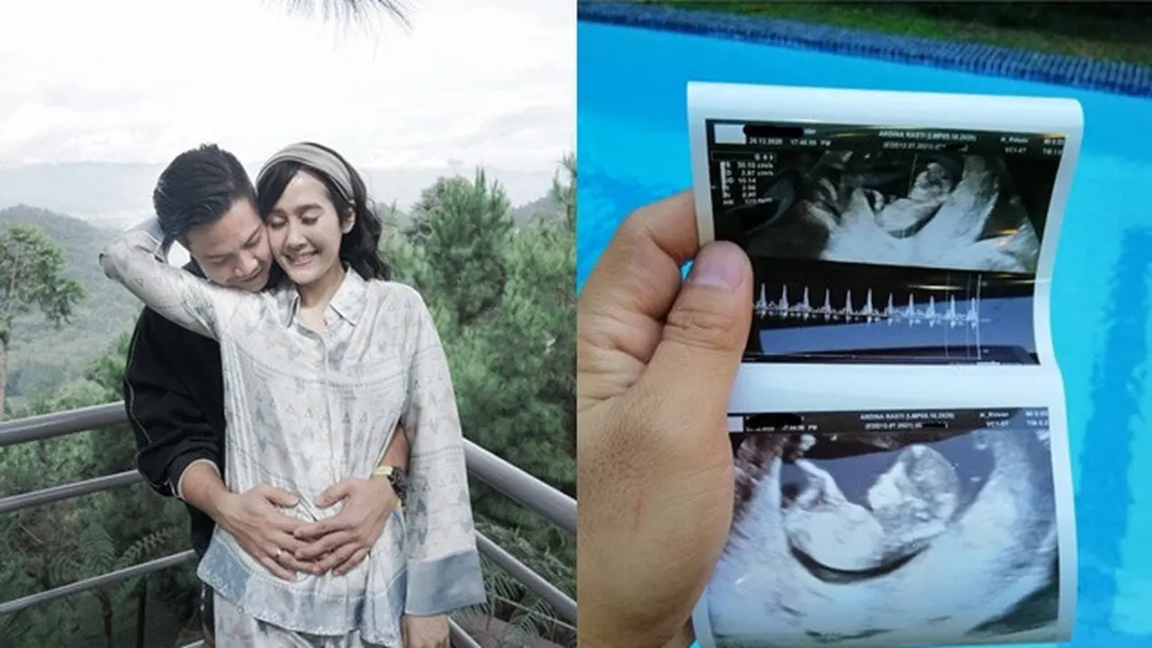 Umumkan Hamil Anak Kedua, Ini 6 Potret Mesra Ardina Rasti dan Arie Dwi Andhika