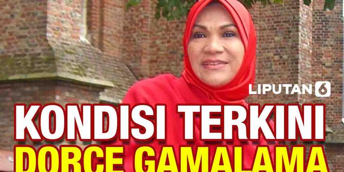VIDEO: Kondisi Terkini Dorce Gamalama, Tampil Lebih Kurus
