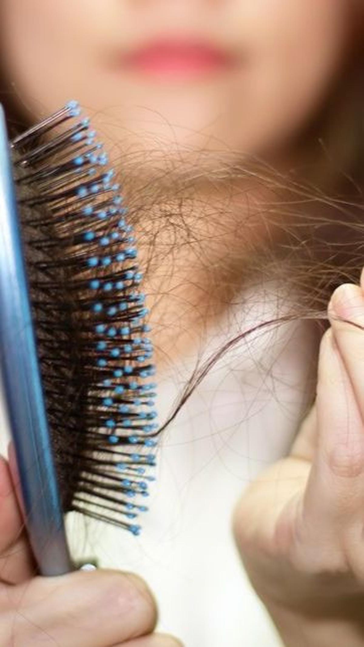 Rambut Rontok Normal dan Tidak Normal