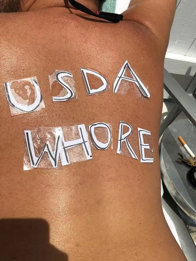 Sunburn Tattoo/Art