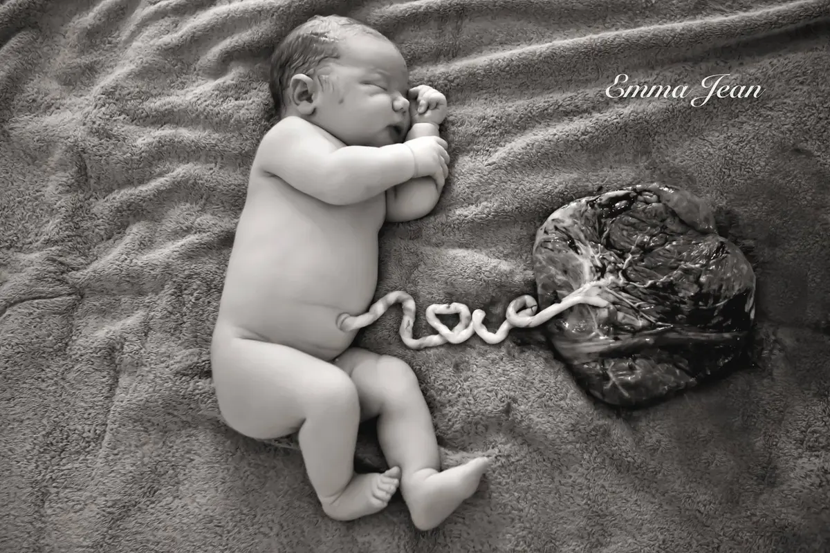 Bidan Ini Abadikan Plasenta Bayi Lewat Foto Menyentuh Hati