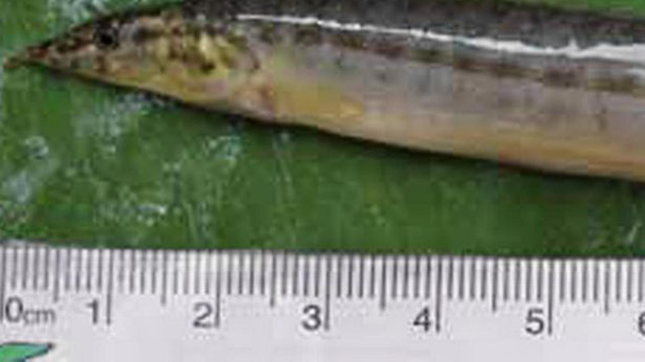 Telah Belut Hidup, Remaja Ini Hampir Tewas