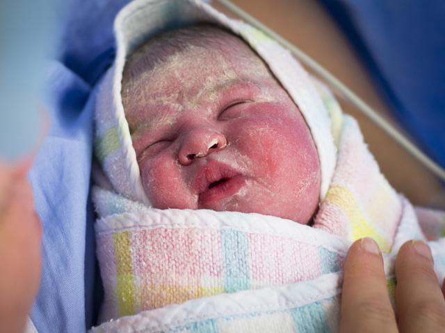 Mengenal Vernix Lapisan Pelindung Kulit Bayi Yang Sering Disangka Kotoran Health Liputan6 