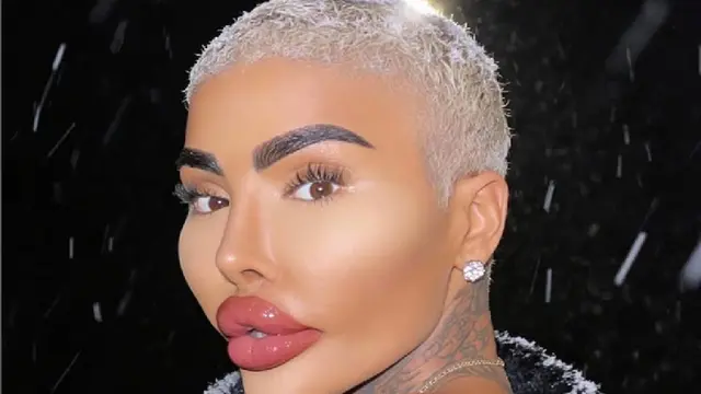 Akhir Tragis Pria yang Terobsesi Menjadi Kim Kardashian, Meninggal Diduga karena Operasi Plastik