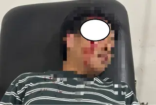 Anak purnawirawan Polri aniaya pegawai bank. (Istimewa)