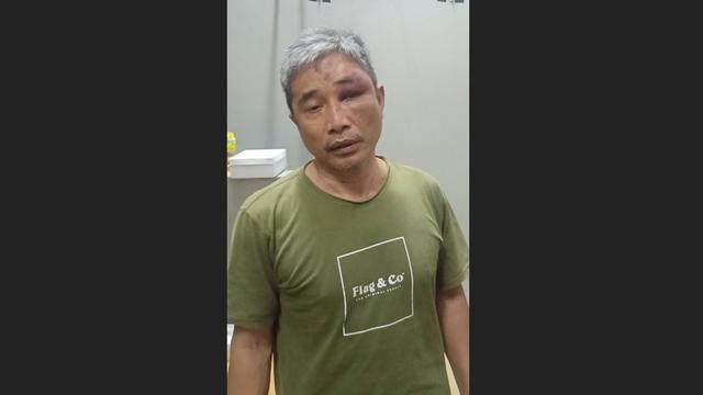 Foto terbaru Muhammad Kece dengan wajah lebam beredar di aplikasi perpesanan.