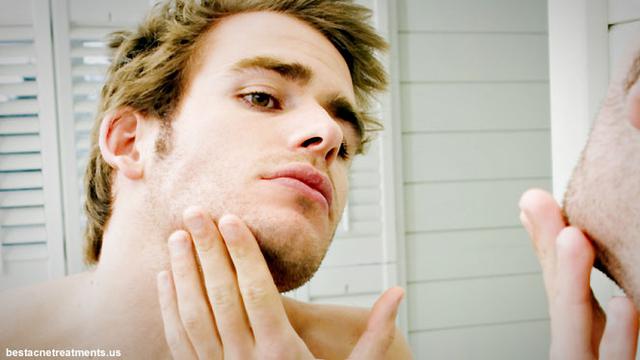 Acne Diet Tubuh Langsing Jerawat Pun Hilang Health