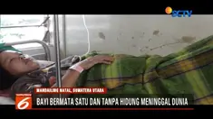 Sembilan jam usai dilahirkan, bayi perempuan yang lahir dengan kondisi memiliki satu mata di Mandailing Natal, Sumatra Utara, akhirnya meninggal dunia.