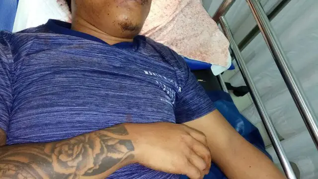 Korban pengeroyokan tiga warga negara Tiongkok di Bali