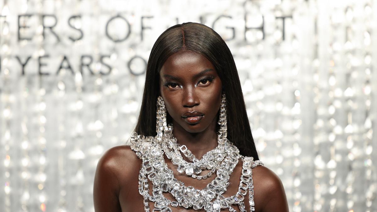 Supermodel Anok Yai Pakai Selang Bantuan Pernapasan, Ungkap Alami Kelainan Paru-paru Bawaan