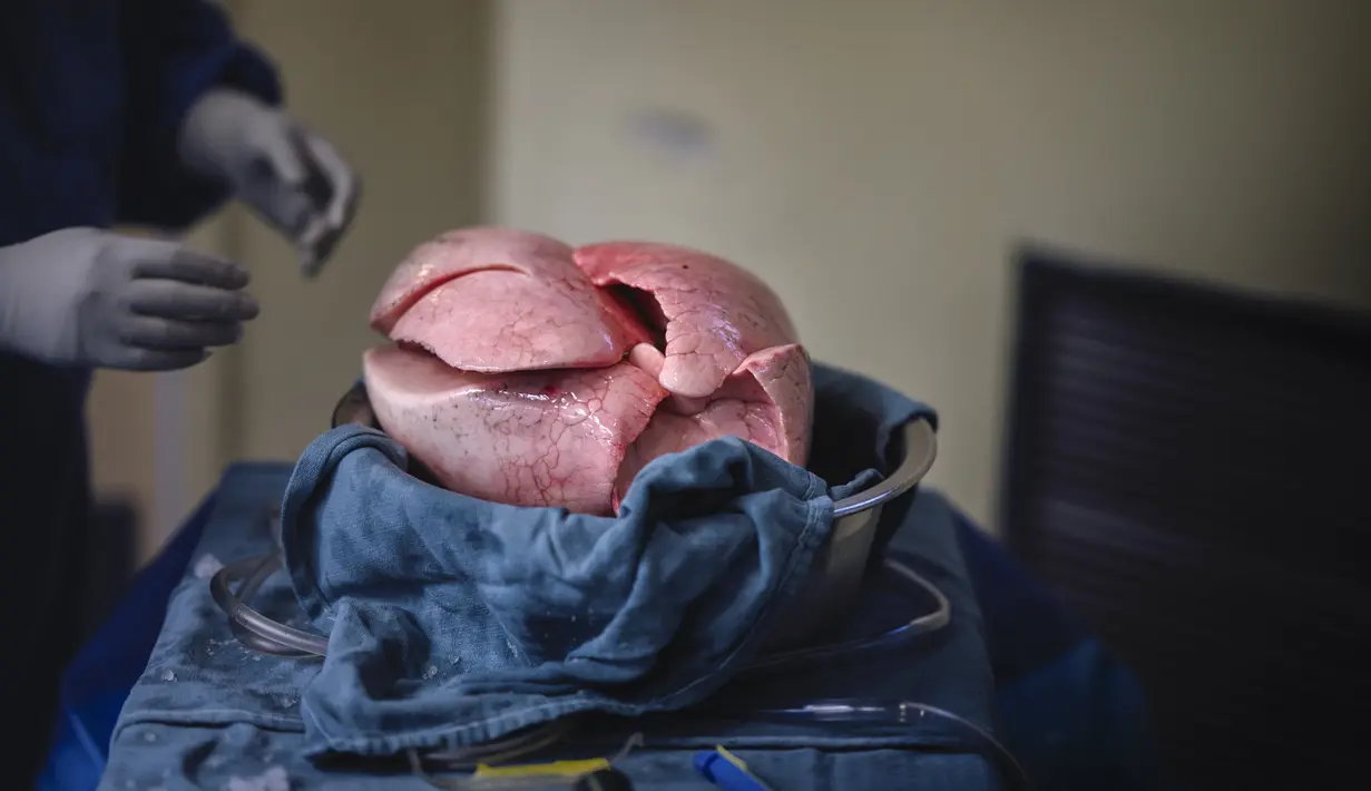Foto yang dirilis September 2021 menunjukkan sepasang paru-paru transplantasi medis pertama di dunia yang dikirim oleh drone Unither Bioelectronique, di Toronto, Kanada. Drone tersebut menempuh jarak 1,5 km dengan perjalanan selama enam menit. (Jason van Bruggen/Unither Bioelectronique/AFP)