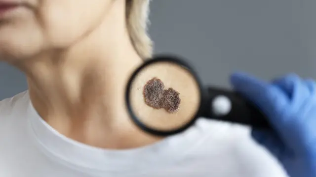 2. Melindungi dari Risiko Kanker Kulit [Dok/freepik.com]