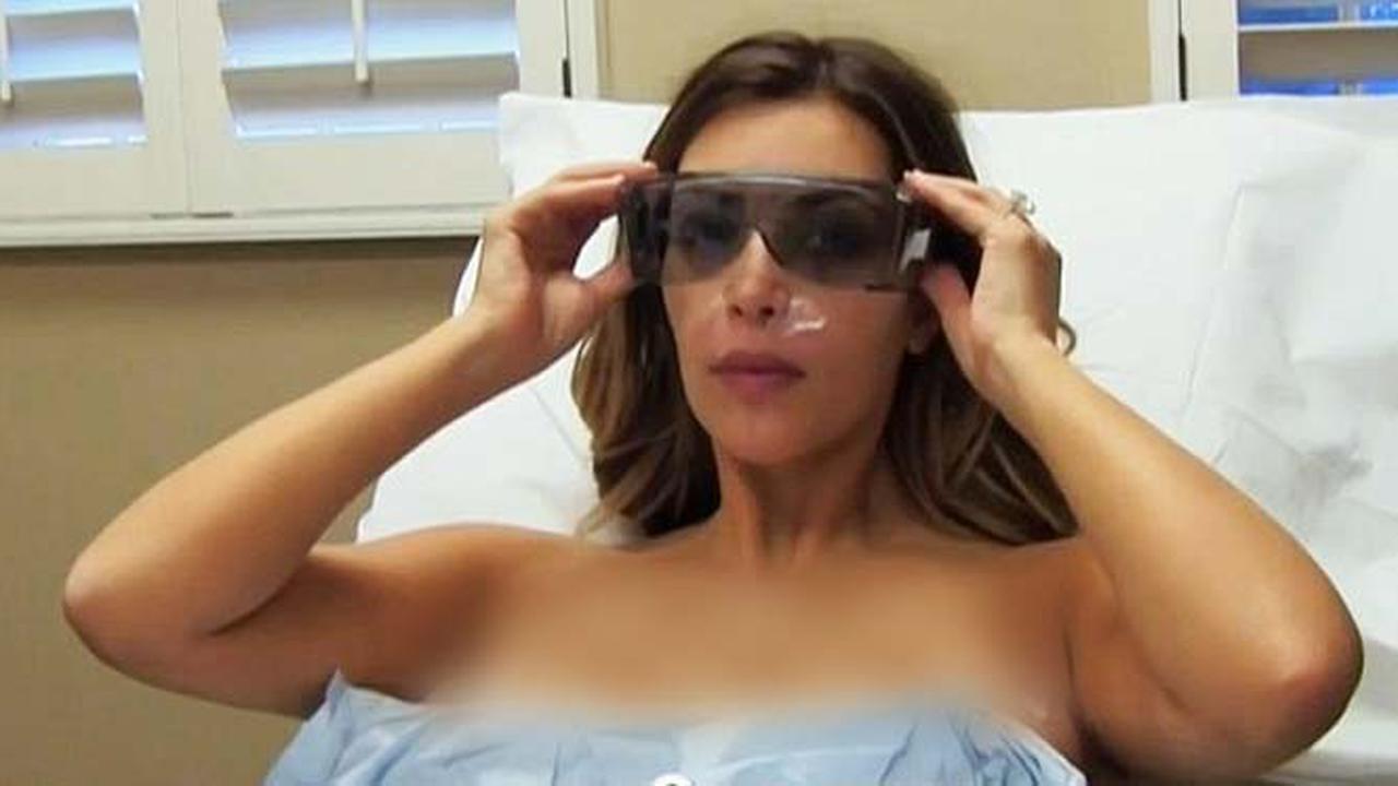 Kim Kardashian Operasi Laser