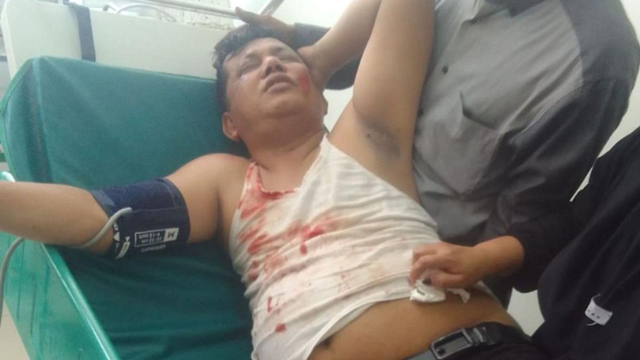 Korban terjatuh dan mengalami luka di kepala hingga mengeluarkan darah.