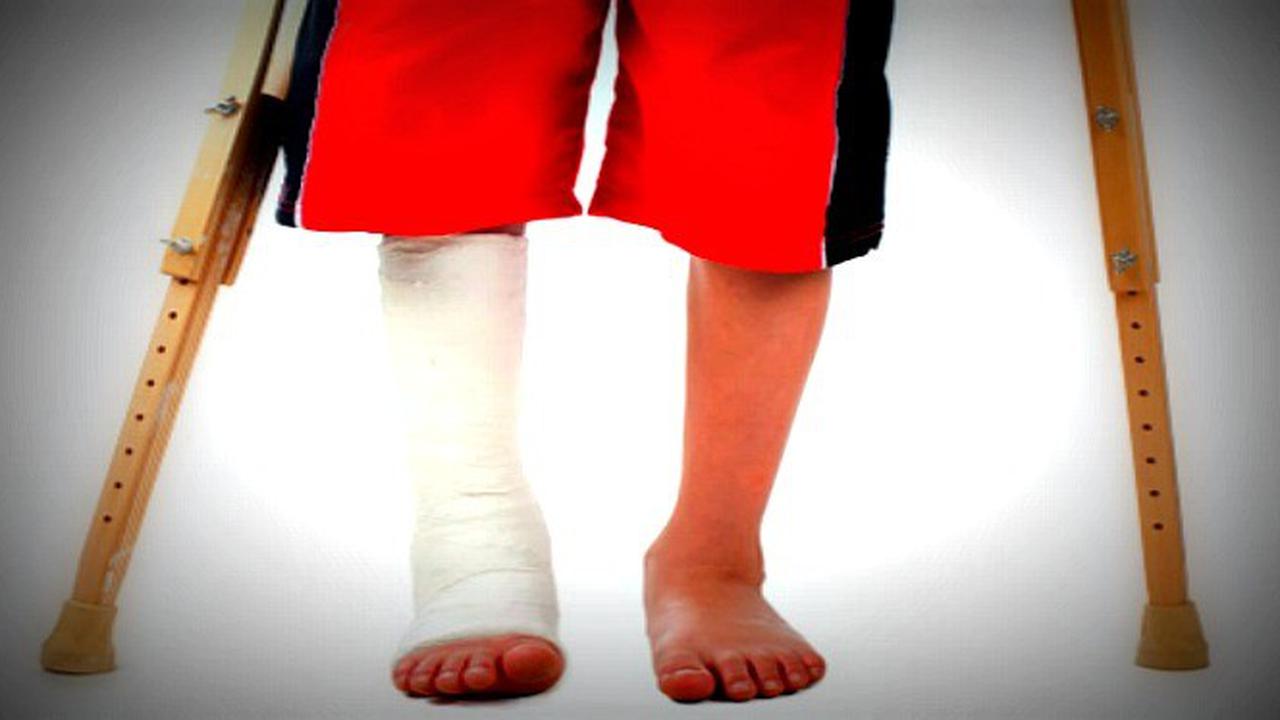 Ilustrasi Patah Tulang