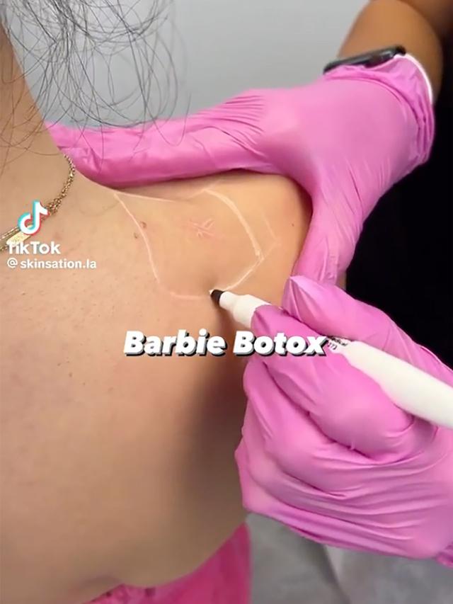 Barbie Botox