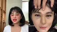 Potret Artis Ini Wajahnya Terlihat Bengkak Usai Operasi (Sumber: Instagram/dewiperssik9, angelalee87)