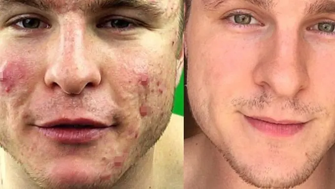 Photo: Copyright dailymail.co.uk