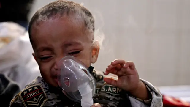 Anak-anak Delhi paling terkena dampak kabut asap