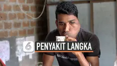 vertical penyakit langka