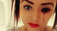 Lagi, Perempuan Ini Menangis Darah, Apa Sebenarnya yang Terjadi?
