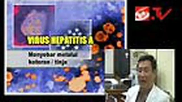 Inilah Cara Mencegah Hepatitis A