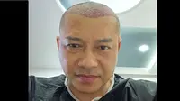 Anang Hermansyah Berkepala Botak, Disebut Mirip Raul Lemos