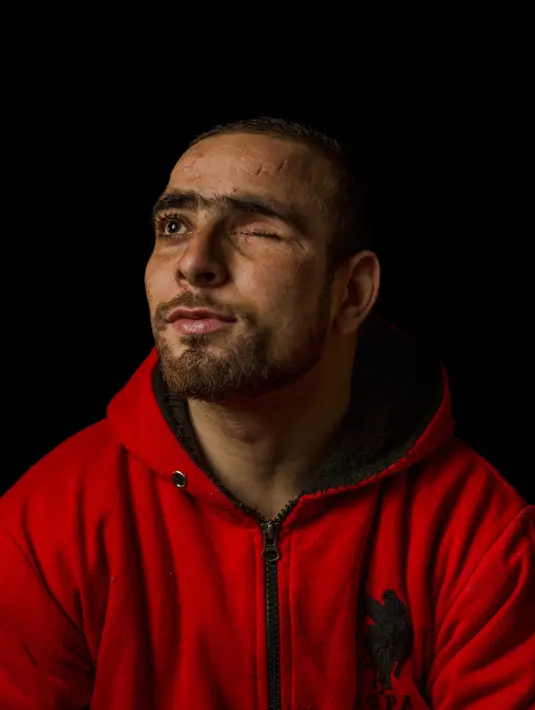 Danish Rajab Jhat (24) berpose di Srinagar, Kashmir, India 1 Desember 2016. Peluru yang menghilangkan mata kirinya membuat Danish mengikuti organisasi Amnesty International yang memperjuangkan penghentian penggunaan senapan. (AP Photo / Bernat Armangue)
