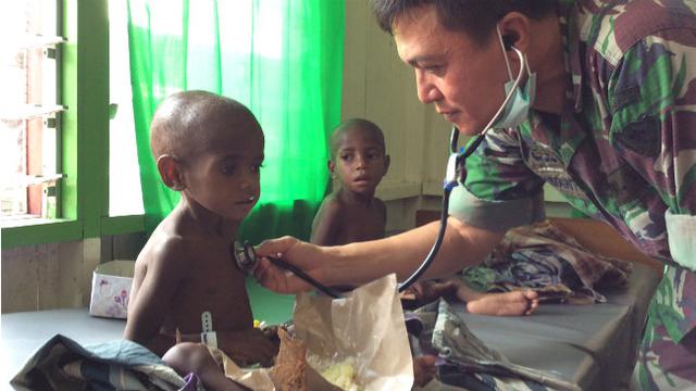 Wabah Campak dan Gizi Buruk di Asmat