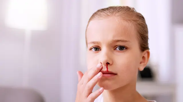 Waspada Terkena Hemofilia Jika Anak Sering Mimisan