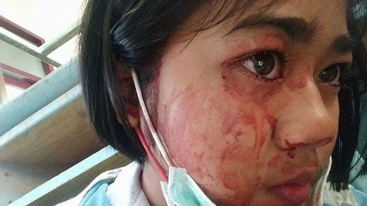 Kisah Anak Perempuan yang Menangis Darah