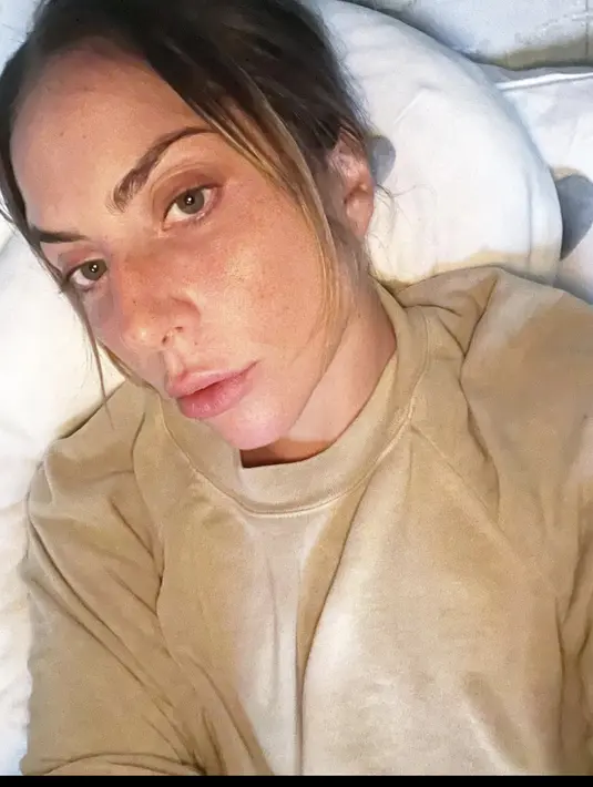 Meskipun sesekali kulit wajahnya tampak kemerahan, namun tentunya ia tanpa ragu membagikannya di media sosial. Sebuah wujud self love yang inspiratif.  [Foto: Lady Gaga/ Instagram]