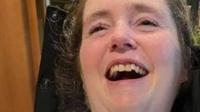 Woman Wakes Up From a 5-Years Coma Because of Her Mom