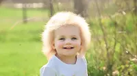 Bayi Taylor mengidap sindrom langka, yang membuat rambutnya jabrik mirip Albert Einstein. (Facebook Baby Einstein 2.0)