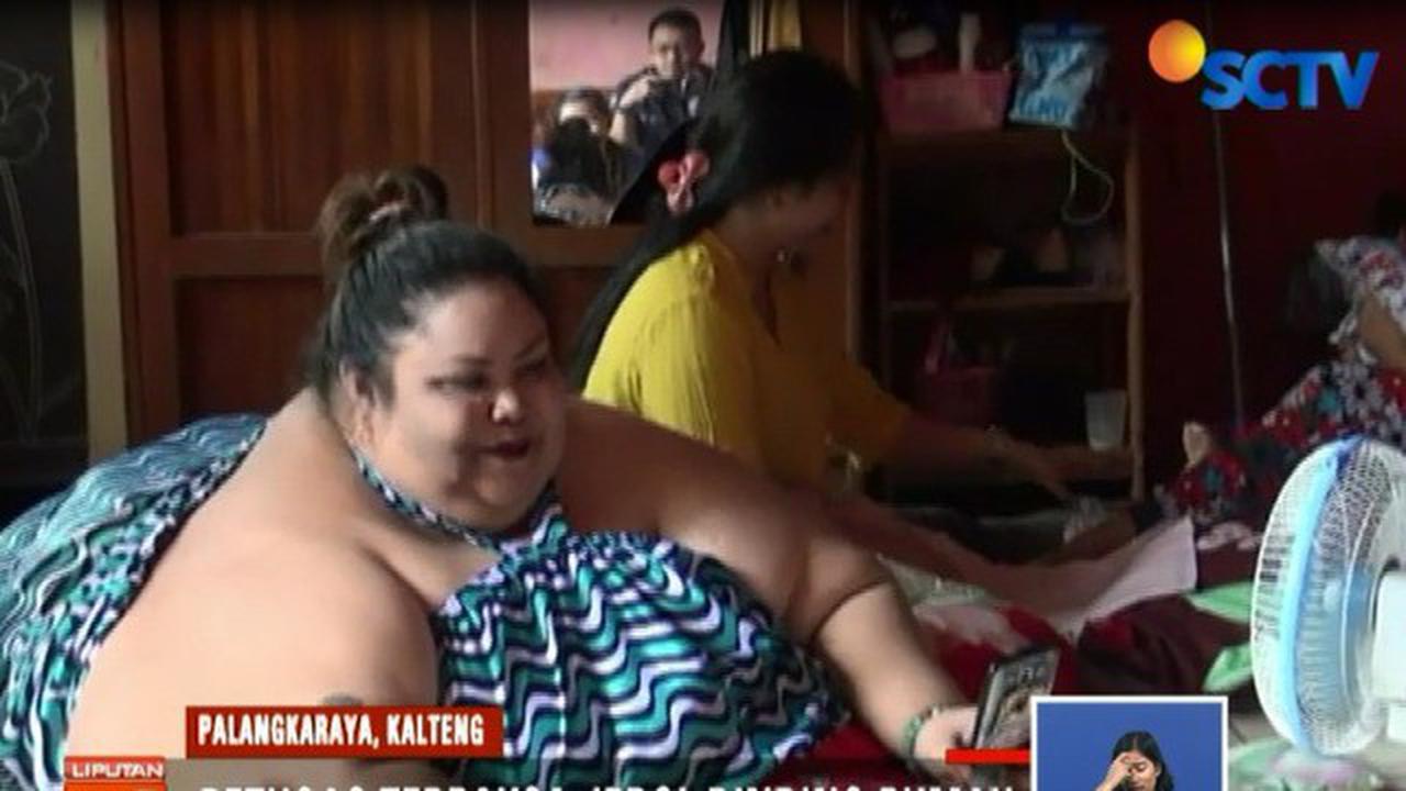 Titi Wati Penderita Obesitas di Palangka Raya Akan Ditangani 6 Dokter Ahli