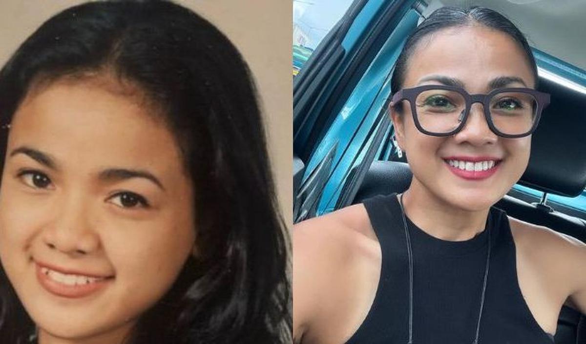 Nirina Zubir memiliki gigi gingsul saat remaja.&nbsp;