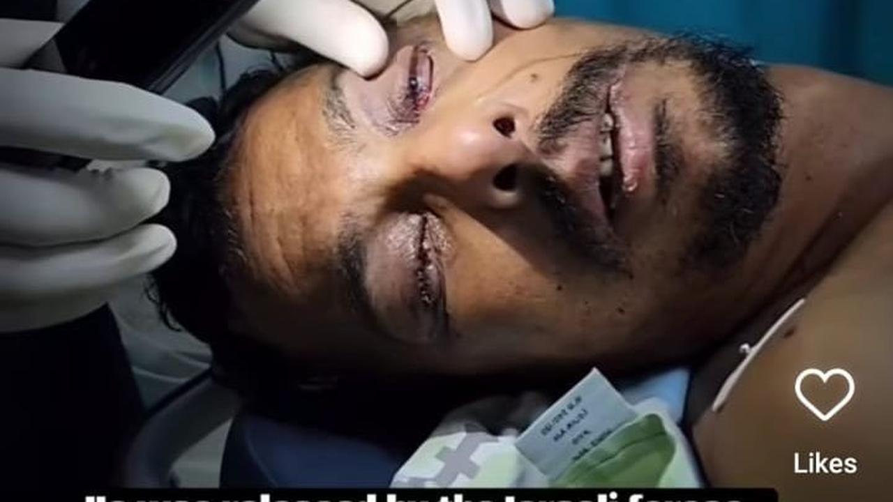 Tuai Kecaman